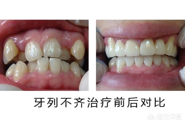 诸暨最新24小时牙医在线咨询方法分析(最方便真实的诸暨有没有24小时牙医方法)