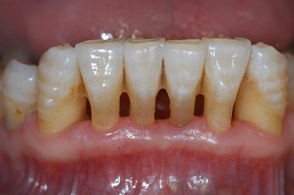 诸暨最新24小时牙医在线咨询方法分析(最方便真实的诸暨有没有24小时牙医方法)